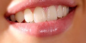  Dents sensibles : les solutions pour les soulager