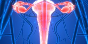 Uterus retroverse : un risque accru de cancer ?