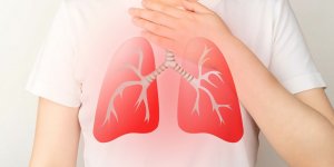 Embolie pulmonaire : comment la prevenir ?