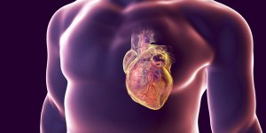Cholesterol et maladies cardiovasculaires : attention a la crise cardiaque