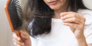 Perte de cheveux : 5 aliments qui aident a l’eviter 