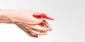 Maladie de Raynaud : 5 signes a reconnaitre sur vos mains