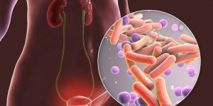 Infection urinaire : 7 aliments a eviter en cas de cystite