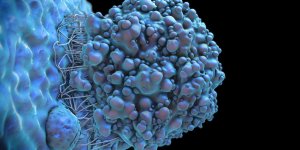 Coronavirus : ce qu’il faut absolument savoir si vous avez un cancer