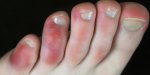 Maladies : 10 signes révélateurs sur vos pieds 