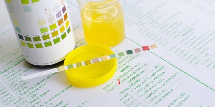 analyse d'urine en utilisant une bandelette de test