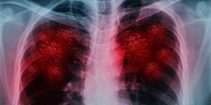 (Photo) : les poumons post-Covid semblent pires que ceux des fumeurs, prévient une chirurgienne