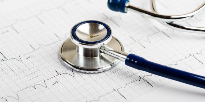Arythmie cardiaque : 3 complications à craindre