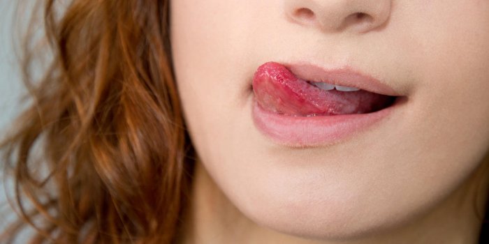 Infection au coin des lèvres : qu'est-ce que la perlèche ?