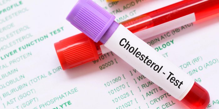 Cholestérol HDL bas : quels sont les risques ?