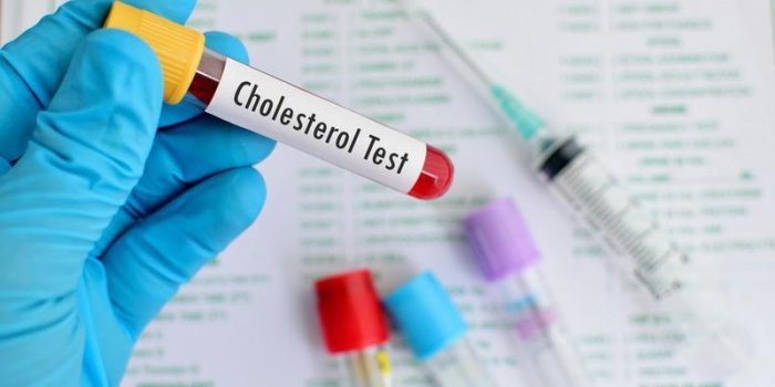 échantillon de sang pour les tests de cholestérol