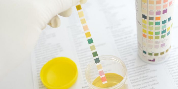 Ce que votre urine peut révéler de votre santé