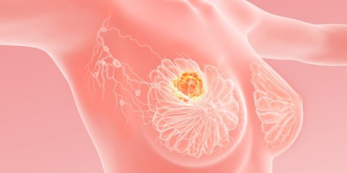 Cancer du sein : le sommeil accélère la prolifération des métastases