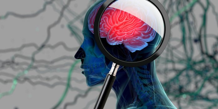 Alzheimer : un seul traumatisme crânien augmente vos risques, selon une étude