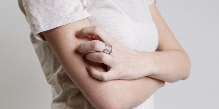 close up view of woman scratching her arm health care and medical concept