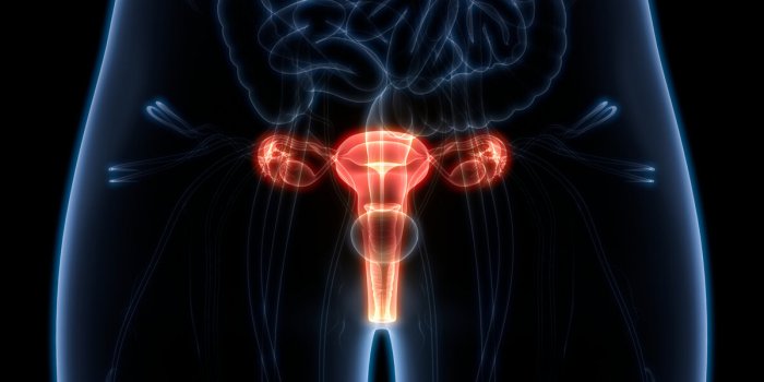 Quelle est la différence entre l’endométriose et le cancer de l’endomètre ?