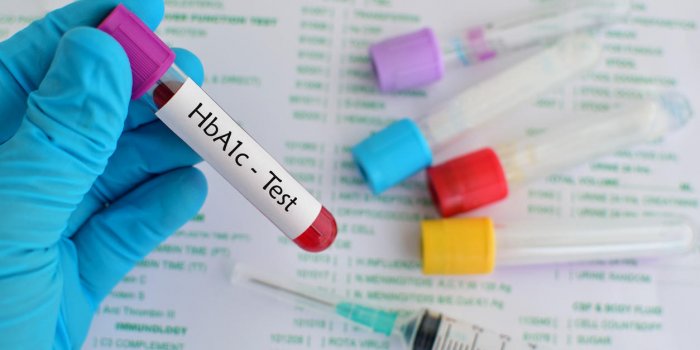 échantillon de sang pour le test de l'hémoglobine a1c (hba1c), diagnostic de diabète