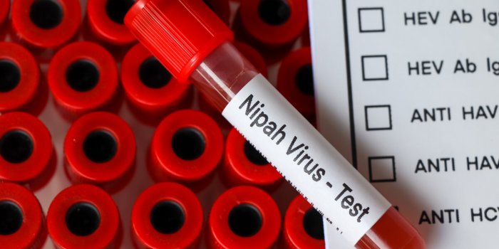 Nipah : qu’est-ce que ce virus qui sévit en Inde ?