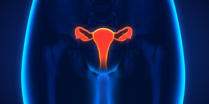 Cancer de l'ovaire : les différents stades