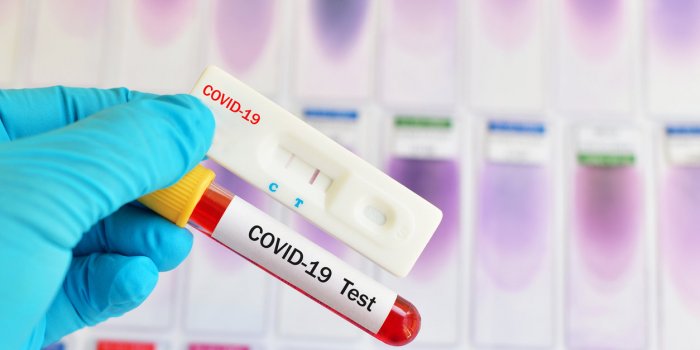 Coronavirus : les nouveaux tests rapides, c'est quoi ?