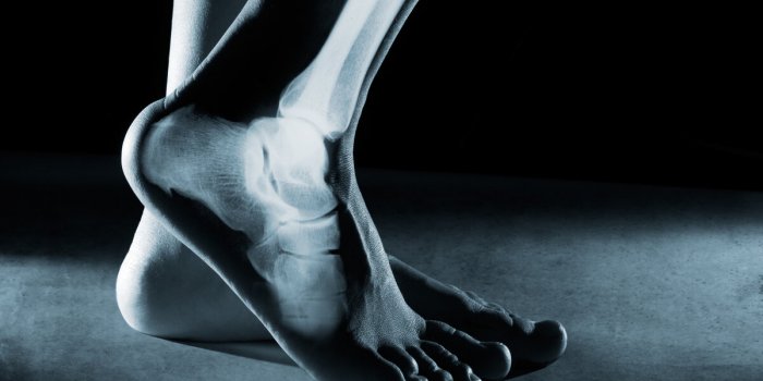 human foot ankle and leg in x-ray, on gray background