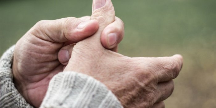 Témoignage arthrose du pouce : comment soulager les symptômes ?