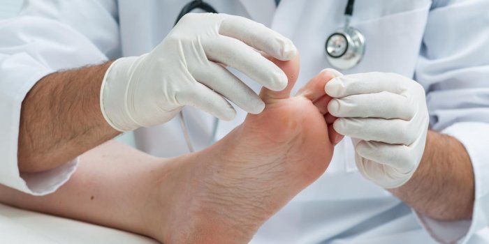 doctor dermatologist examines the foot on the presence of athlete'?s foot