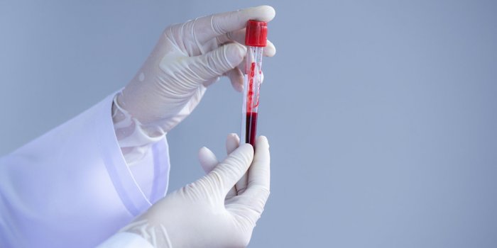 Coronavirus : les groupes sanguins A et AB, plus à risque ? 