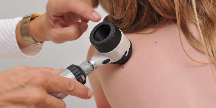 un dermatologue examine la tache de naissance d'un patient avec dermatoscope mole checkup professional dermoscopy