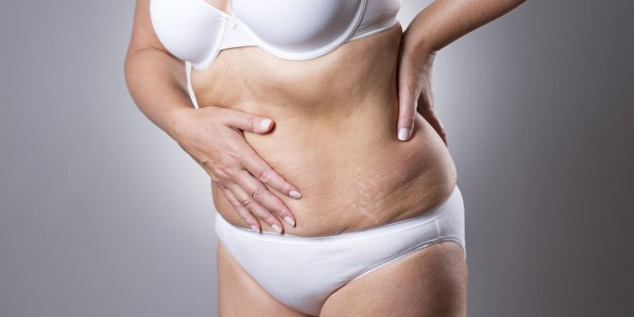 Douleurs en bas du ventre : de quel côté est l'appendicite ?