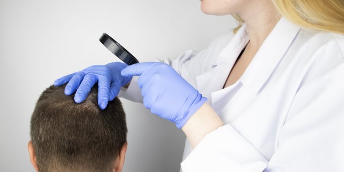 a trichologist examines the hair of a man who begins alopecia consultation with a dermatologist hair loss, alopecia, prur...