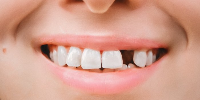  Démence : pourquoi perdre vos dents augmente les risques