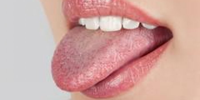 Que révèle votre langue de votre santé ?