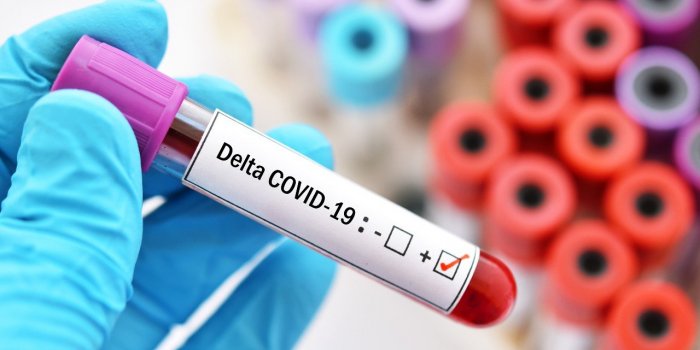 Variant Delta : 7 conseils d’un infectiologue pour y echapper 