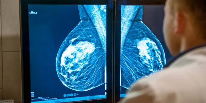 Cancer du sein : cette nouvelle technique de lecture des mammographies qui améliore le dépistage