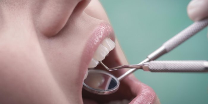 Prothese dentaire amovible : la pose a l-etranger dangereuse ? 