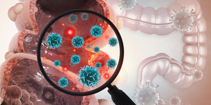 Cancer colorectal précoce : le microbiote intestinal en cause ?
