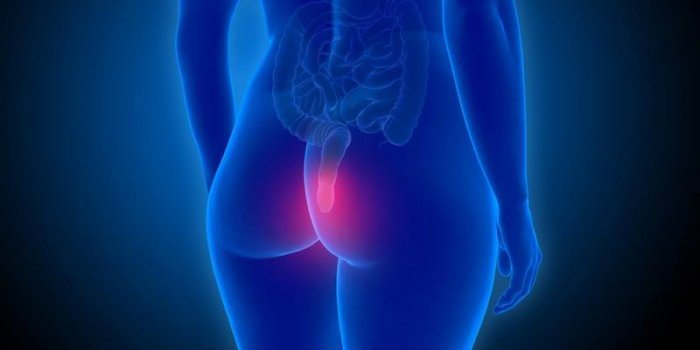 Cancer de l'anus : quels sont les symptômes ?