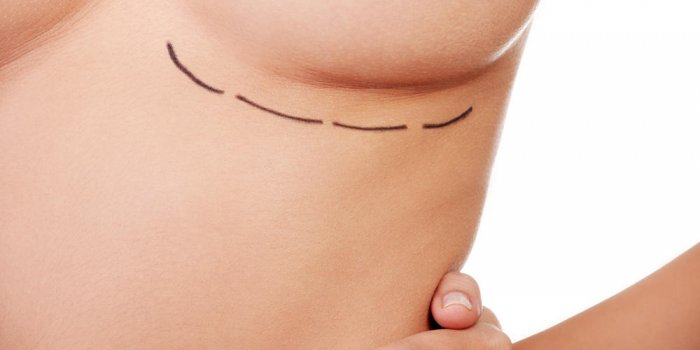 Chirurgie esthétique : le lifting des seins en forte augmentation