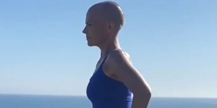&quot;Je voulais montrer ce que le cancer fait a un corps&quot; : elle devoile son corps apres 90 heures de chimiotherapie
