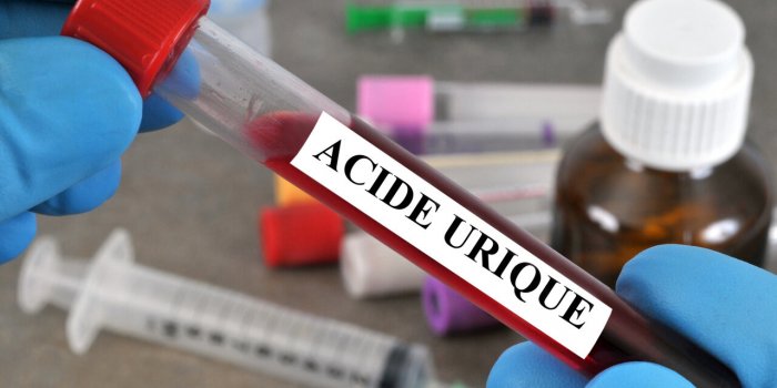 Acide urique : 6 elements qui peuvent expliquer un taux trop eleve