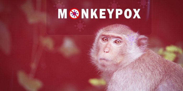 Variole du singe : quels sont les symptomes d-alerte ?