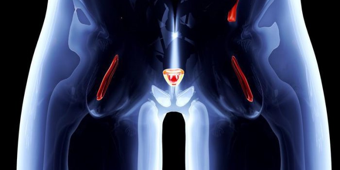 Cancer de la prostate : zoom sur l'examen TEP-choline