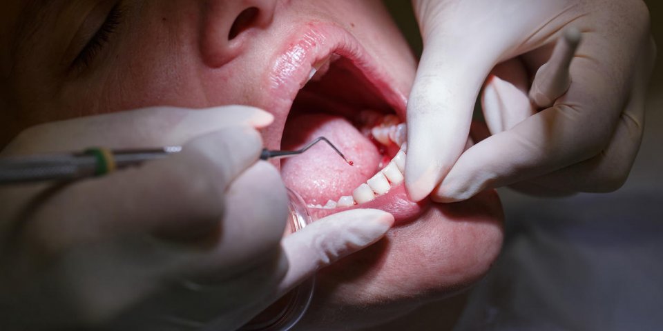 patient at dentists office, getting her teeth examined and cleaned of tartar and plaque, preventing periodontal disease d...