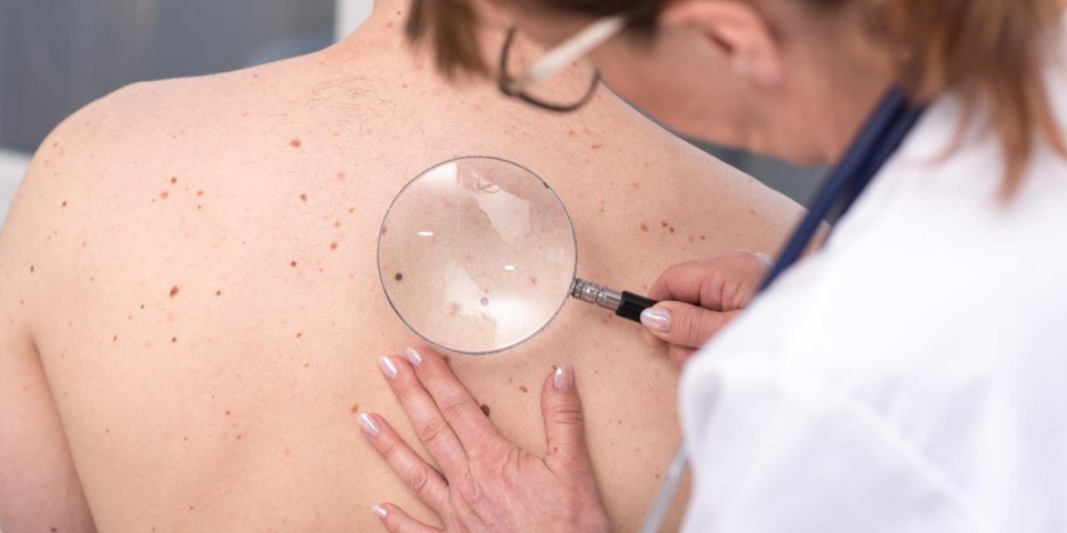 dermatologist examining the skin on the back of a patient