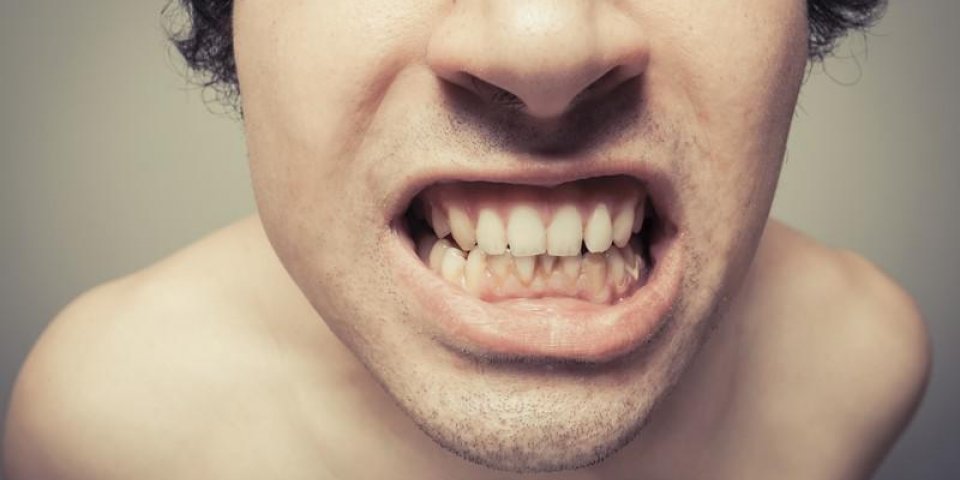 jeune homme montre ses dents sales avec accumulation de plaque