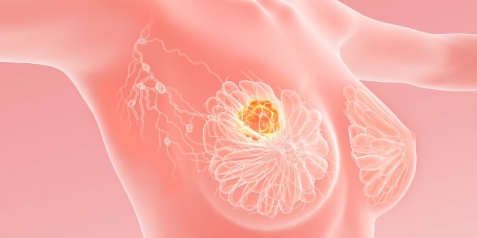 Cancer du sein : le sommeil accélère la prolifération des métastases