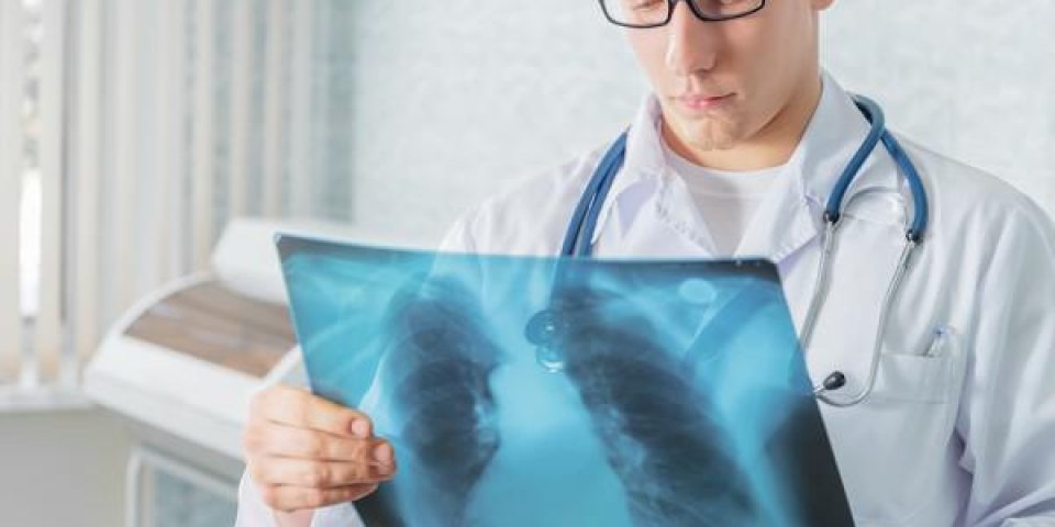 homme médecin regarde une image radiologique des poumons dans une clinique