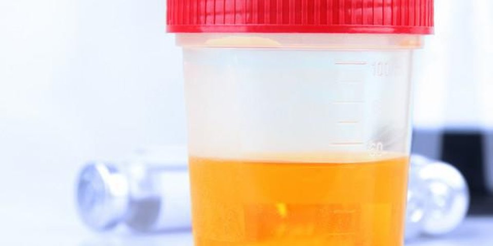 test d'urine médicale, gros plan