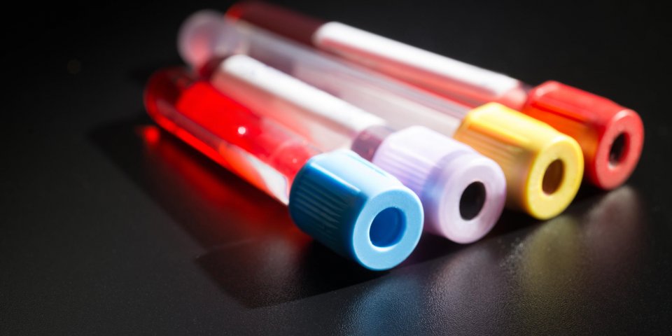 tubes à vide pour recueillir des échantillons de sang dans le laboratoire
